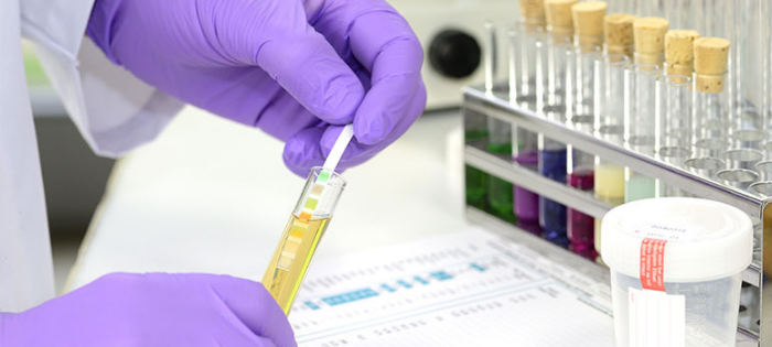 drug testing